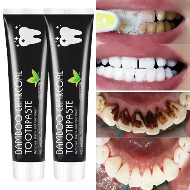 Teeth Whitening Yellow Teeth - Pasta de dientes blanqueadora, pasta de