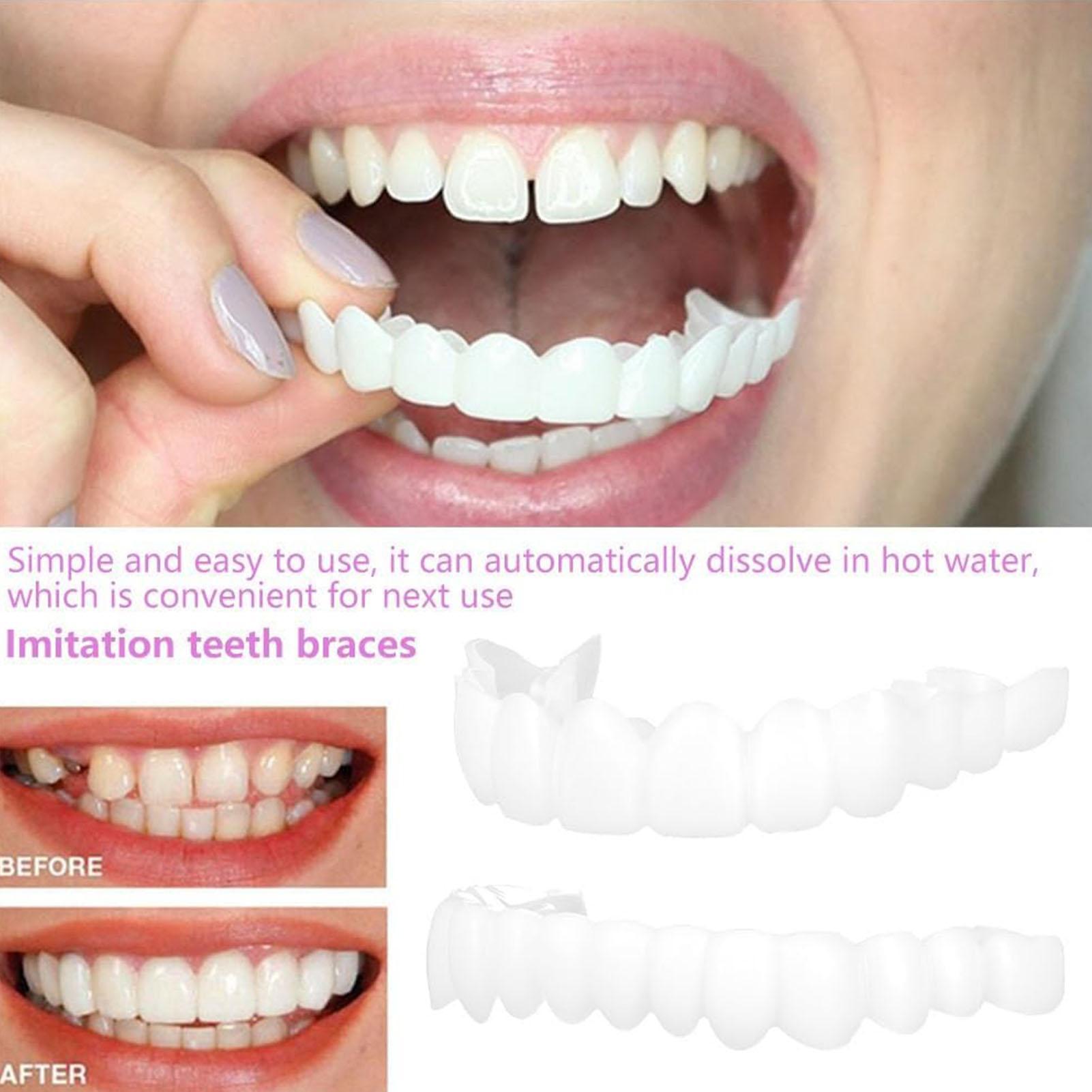 Teeth Whitening Mask - Chapa de dientes temporal para hombres