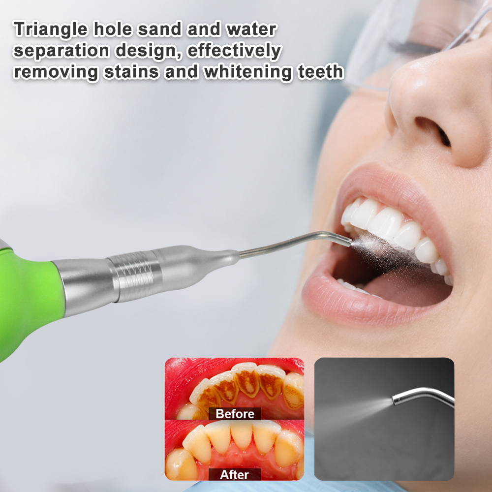 Pulidor Dental de Aire con Dis - Teeth Whitening Options reseña y precio