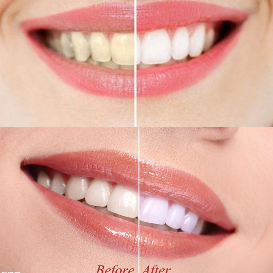 Dientes de carbón de bambú par - Teeth Whitening Charcoal reseña y precio