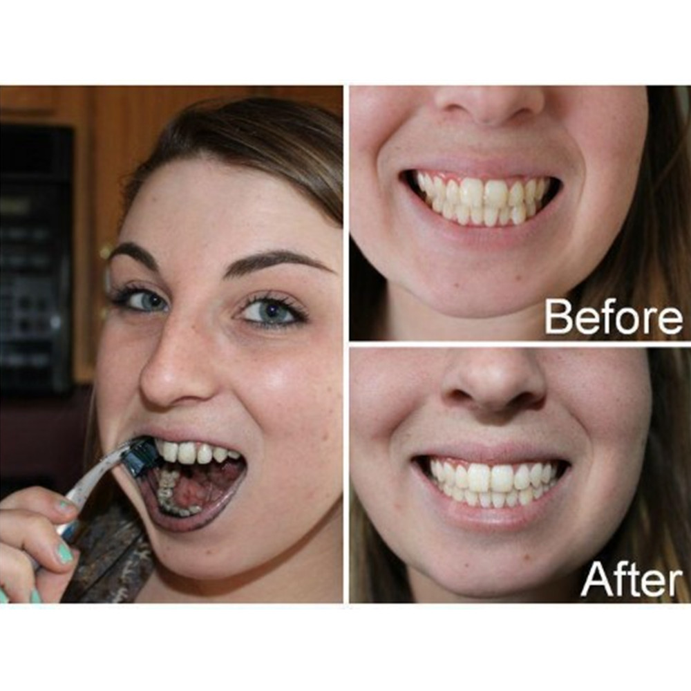 Dientes de carbón de bambú par - Teeth Whitening Charcoal reseña y precio
