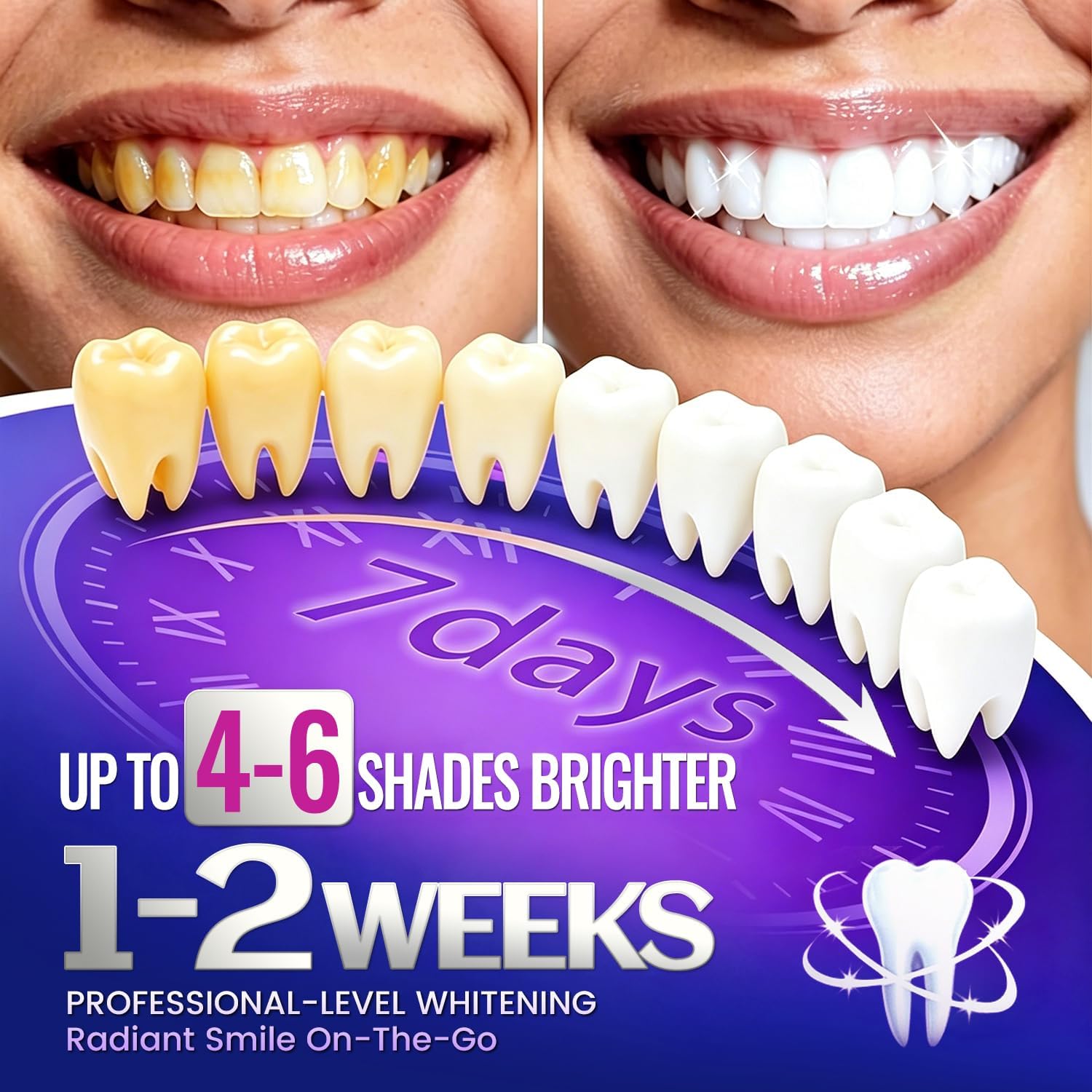 7 pares de tiras blanqueadoras - Teeth Whitening Street reseña y precio