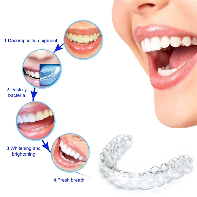 Protector Bucal de Silicona Có - Teeth Whitening With Trays reseña y precio