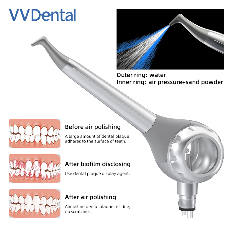 Pistola de arenado dental VV d - Teeth Whitening Free reseña y precio