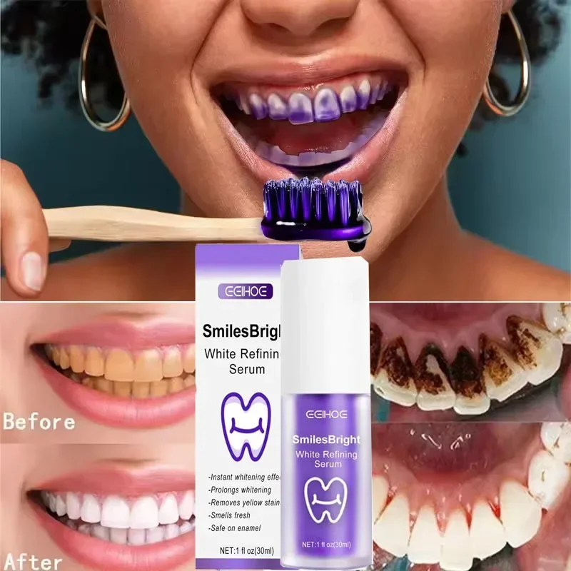 Limpieza de dientes, pasta de  - Teeth Whitening In Korea reseña y precio
