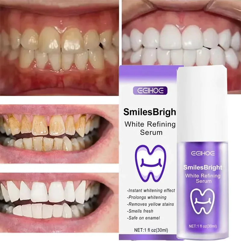 Limpieza de dientes, pasta de  - Teeth Whitening In Korea reseña y precio