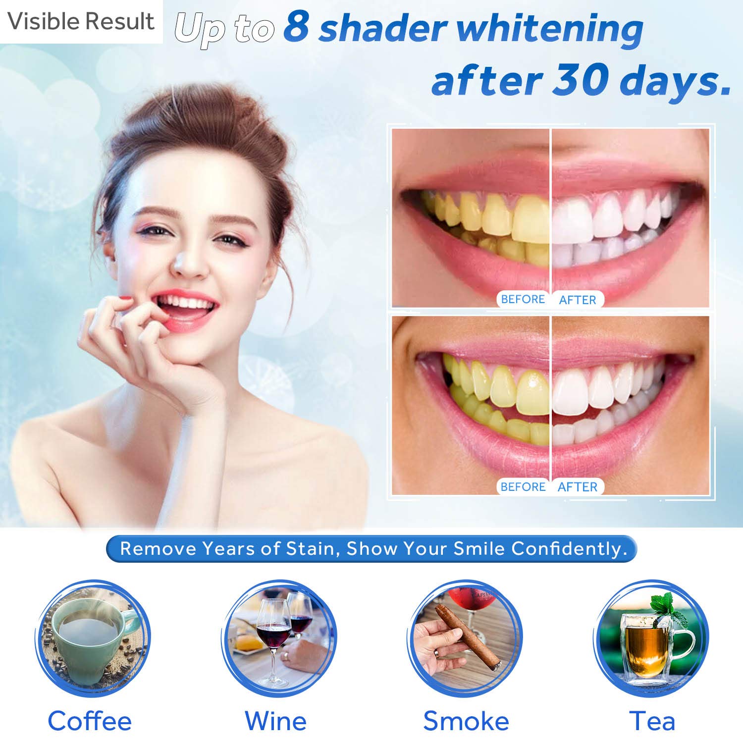Jeringa de repuesto de Gel par - Teeth Whitening Price reseña y precio