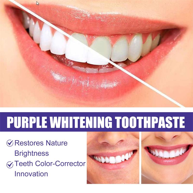 Pasta Dental Blanqueadora 9D P - Teeth Whitening Yellow Teeth reseña y precio