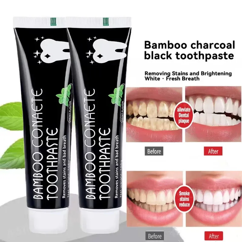 Pasta de dientes blanqueadora, - Teeth Whitening Yellow Teeth reseña y precio