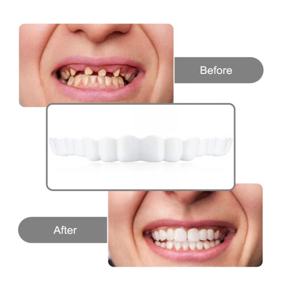 4-6 pares de dentaduras postiz - Teeth Whitening Mask reseña y precio