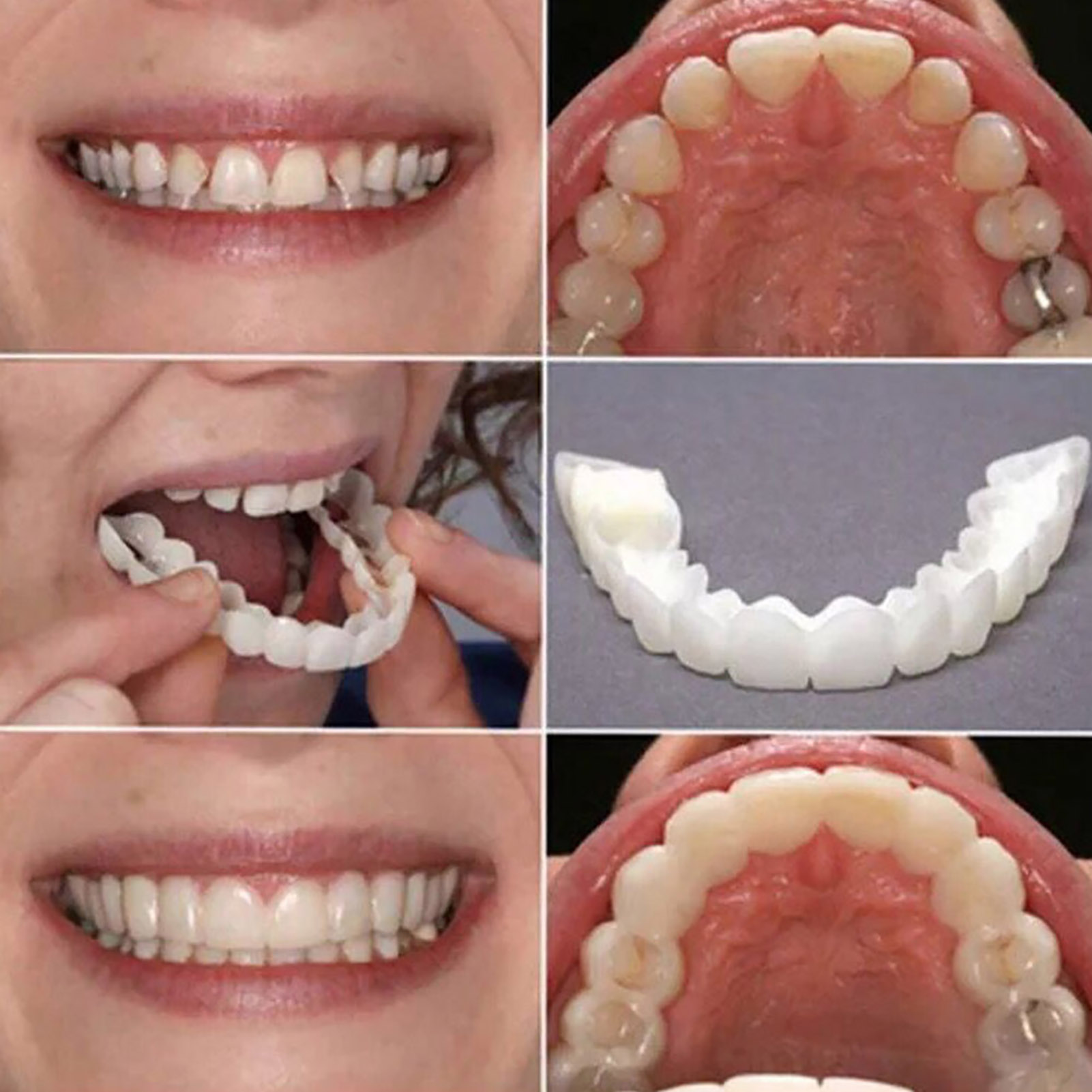 Carillas Dentales Blanqueadora - Teeth Whitening Mask reseña y precio