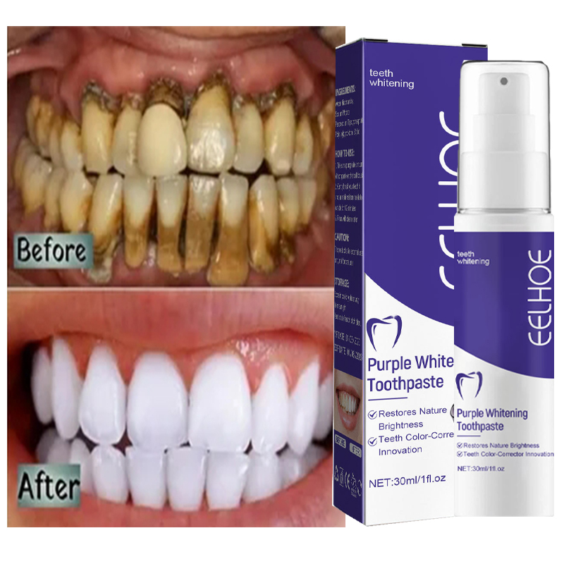 Pasta de dientes piezas limpie - Teeth Whitening In Korea reseña y precio