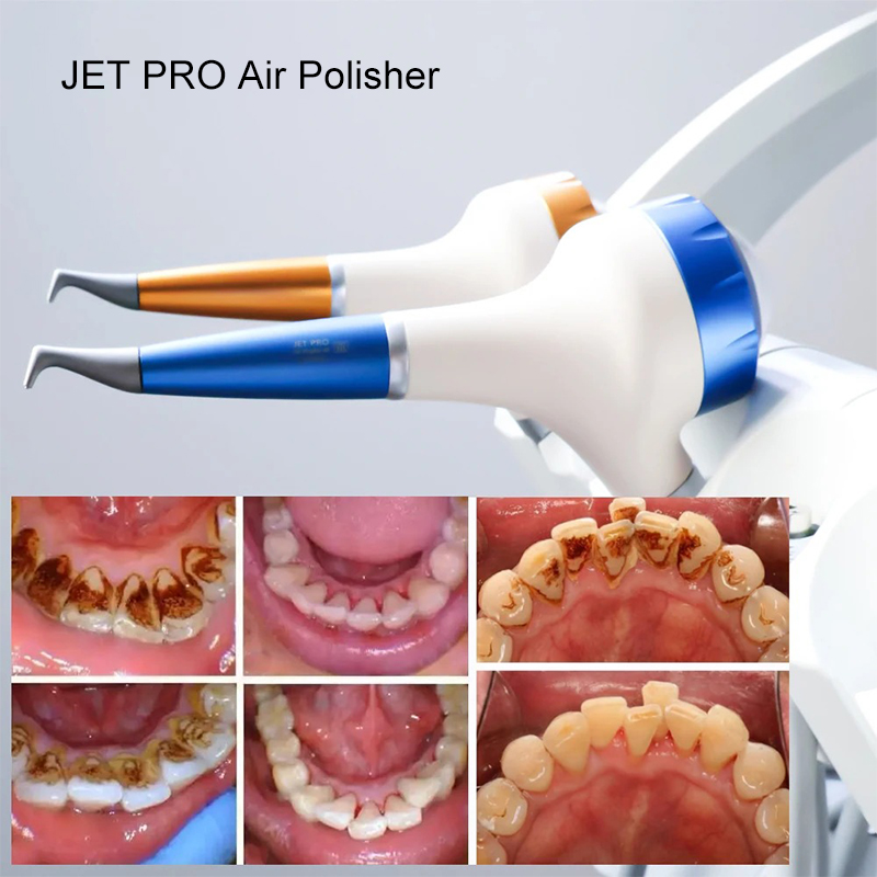 VV Dental Air Polishing Prophy - Teeth Whitening Free reseña y precio