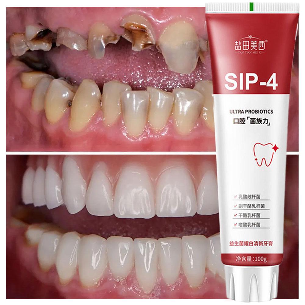 Pasta Dental Blanqueadora Prob - Teeth Whitening Yellow Teeth reseña y precio
