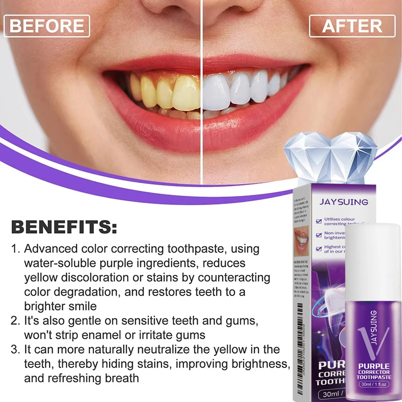 Pasta Dental Blanqueadora, Gel - Teeth Whitening In Korea reseña y precio