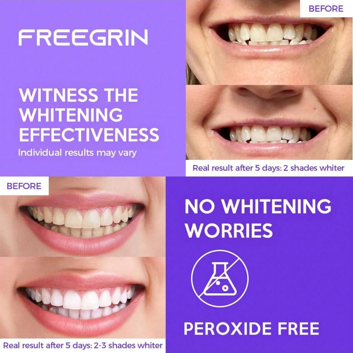 Pegatinas blanqueadoras de die - Teeth Whitening Price reseña y precio