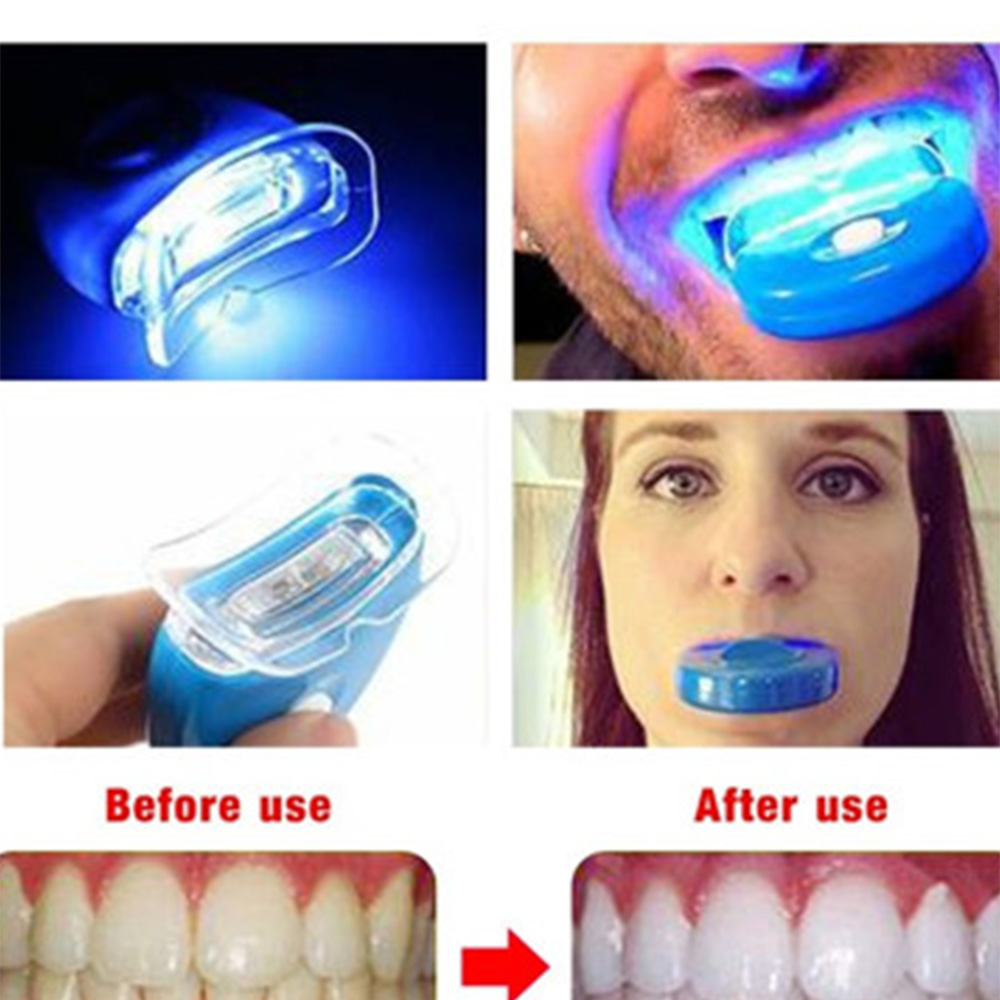 Acelerador de blanqueamiento D - Teeth Whitening With Laser reseña y precio