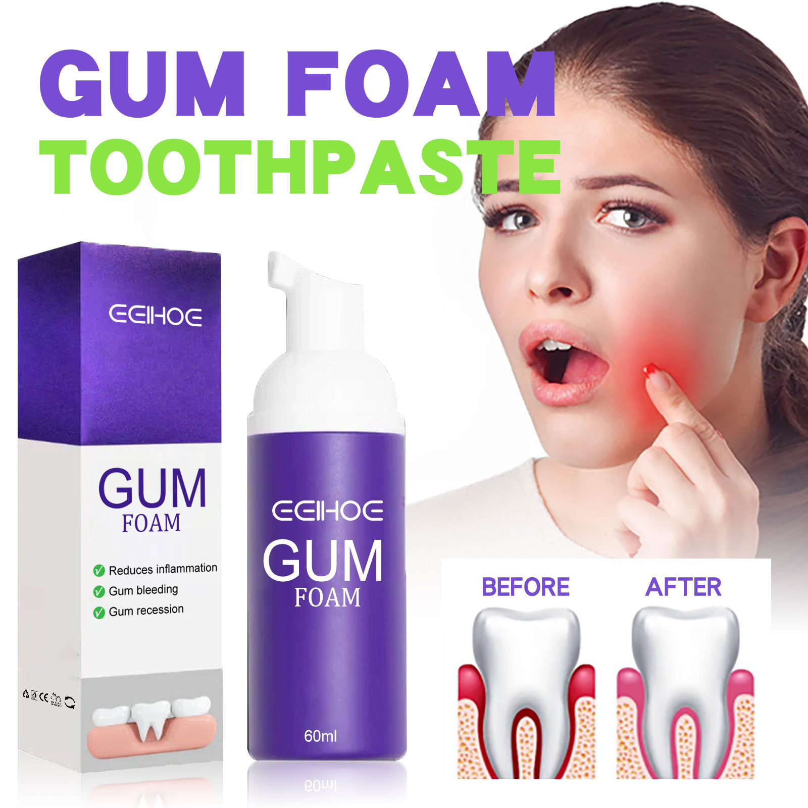 Mousse blanqueador de dientes  - Teeth Whitening Yellow Teeth reseña y precio