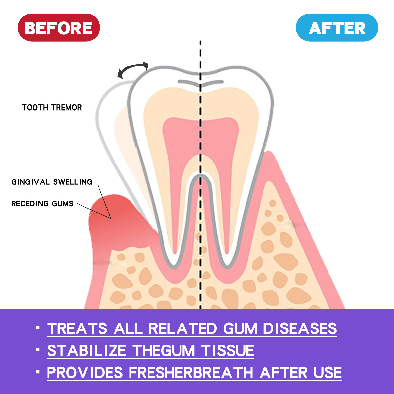 Mousse blanqueador de dientes  - Teeth Whitening Yellow Teeth reseña y precio