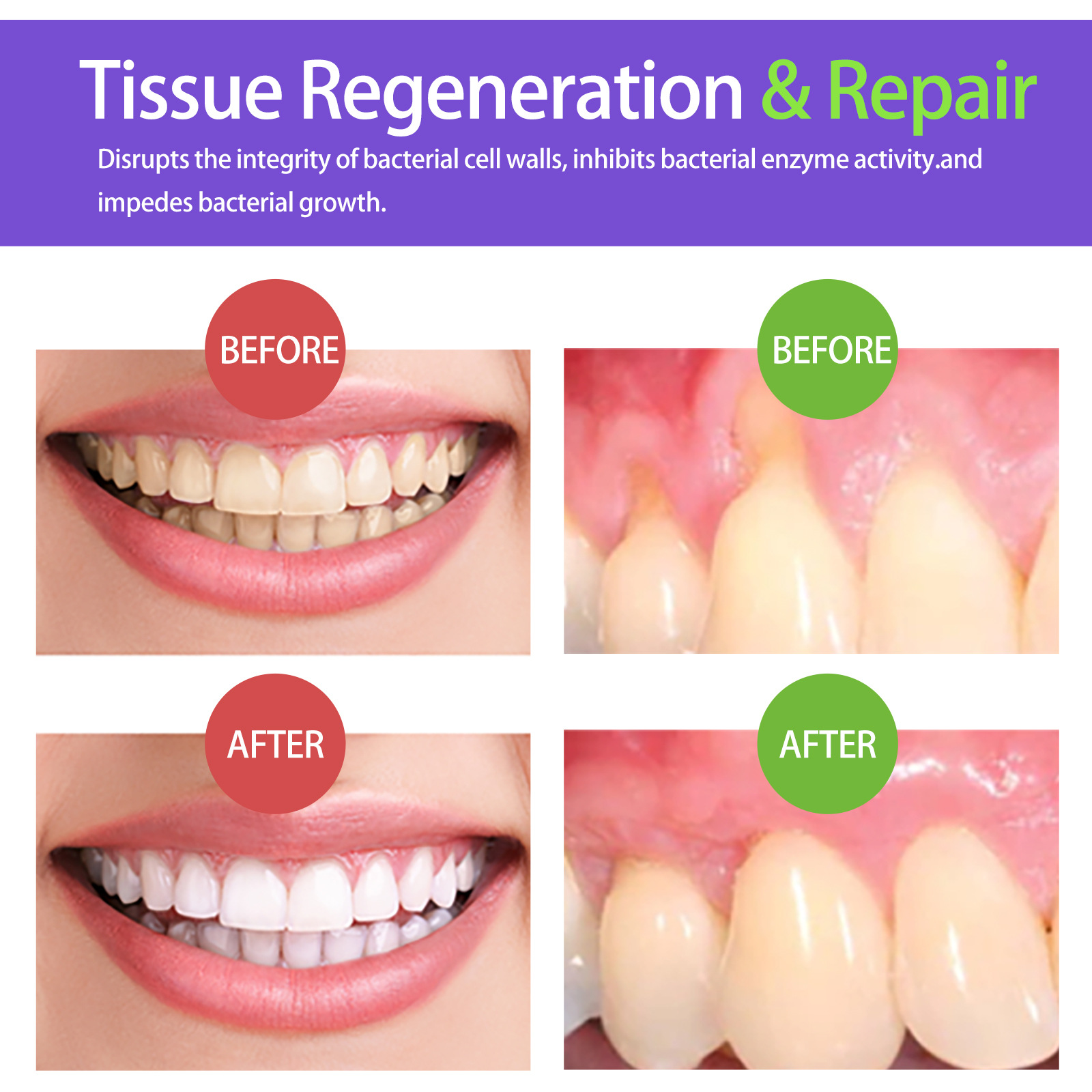 Mousse blanqueador de dientes  - Teeth Whitening Yellow Teeth reseña y precio