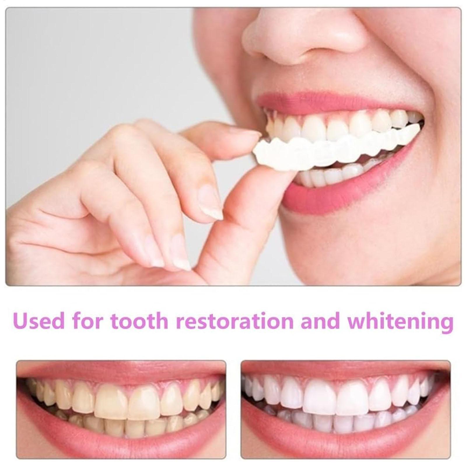 Chapa de dientes temporal para - Teeth Whitening Mask reseña y precio