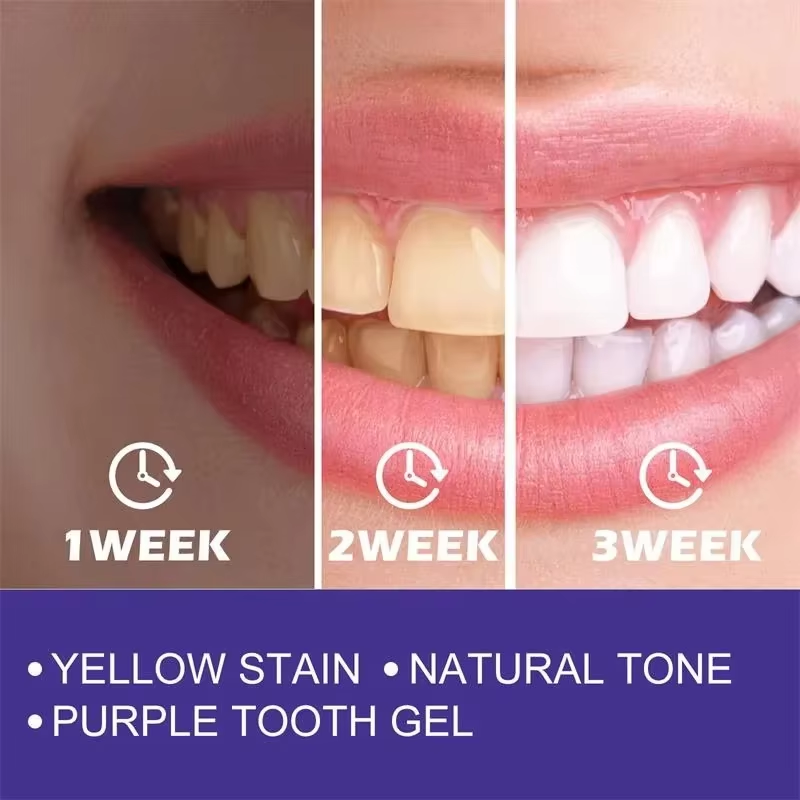Limpieza de dientes, pasta de  - Teeth Whitening In Korea reseña y precio